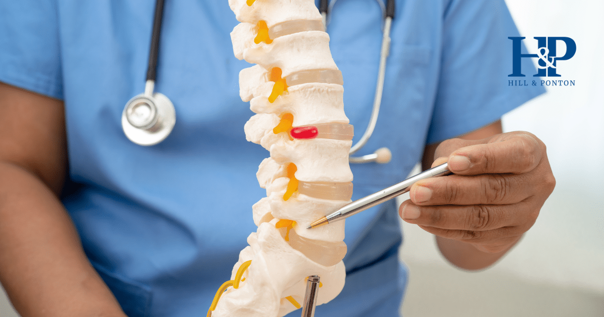 Intervertebral Disc Syndrome VA Rating