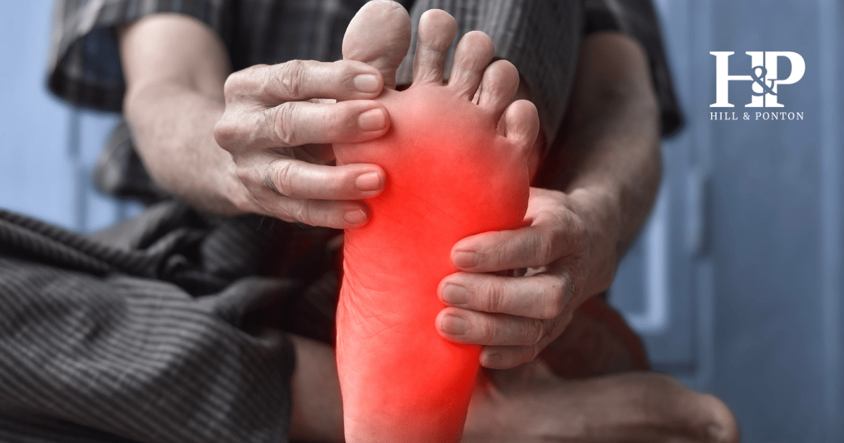 Plantar Fasciitis VA Rating