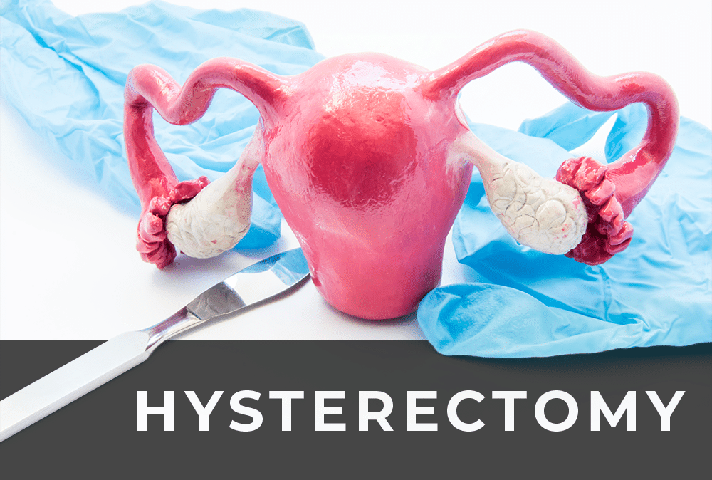 hysterectomy