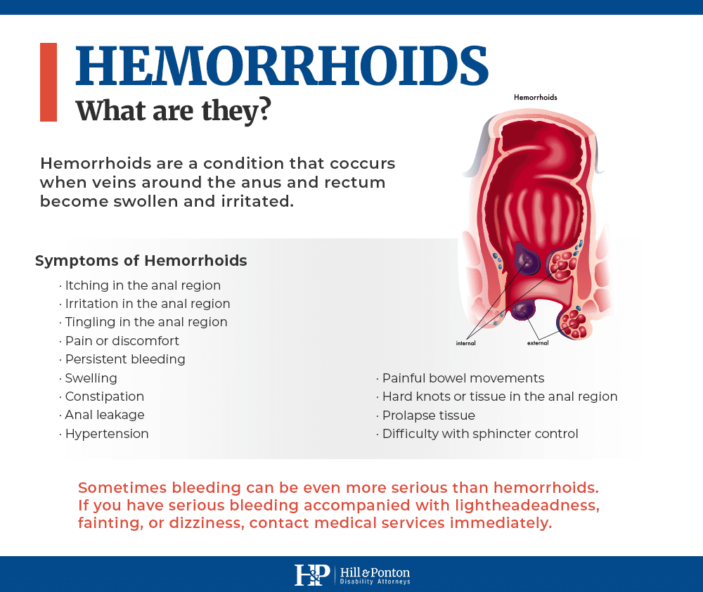 VA Disability Ratings for Hemorrhoids | Hill & Ponton, P.A.