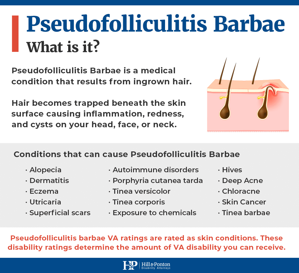 what is pseudofolliculitis barbae