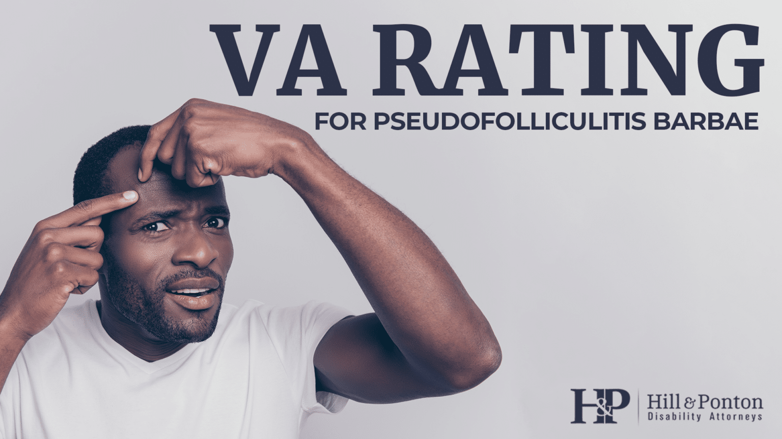 VA Ratings for Razor Bumps (Pseudofolliculitis barbae) Hill & Ponton