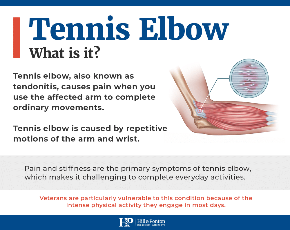 Va Disability Ratings For Tennis Elbow 