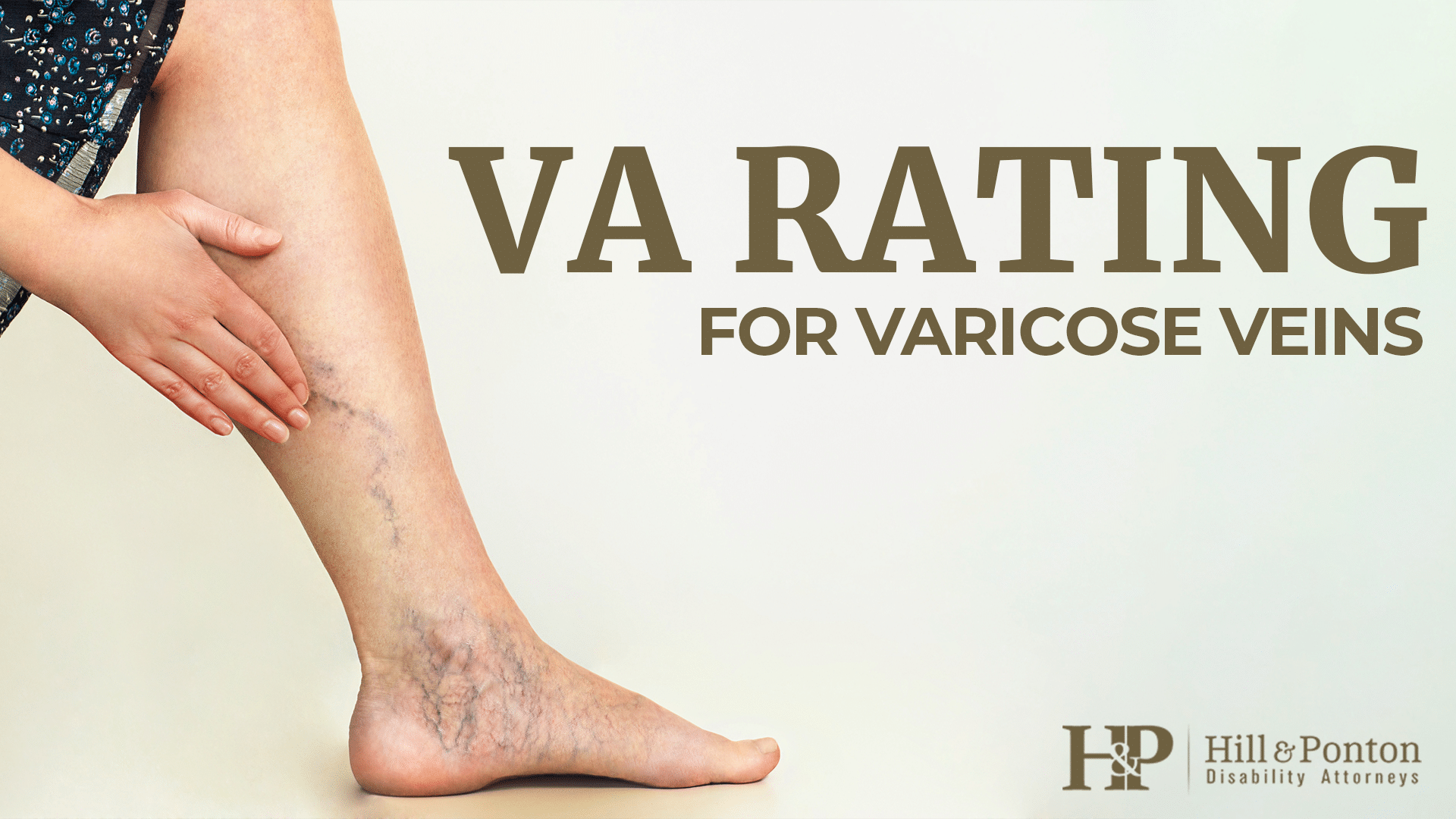 Varicose Veins VA Disability Ratings | Hill & Ponton, P.A.