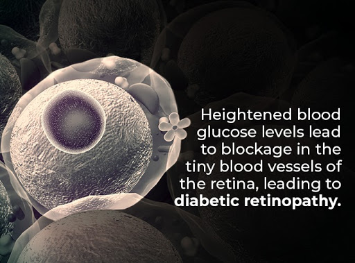 diabetic eye conditions